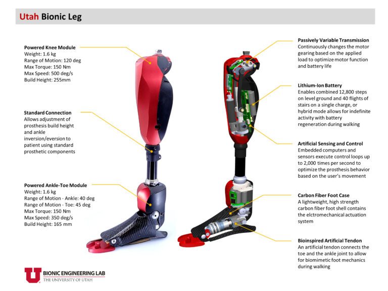 The Utah Bionic Leg: A motorized prosthetic for lower-limb amputees