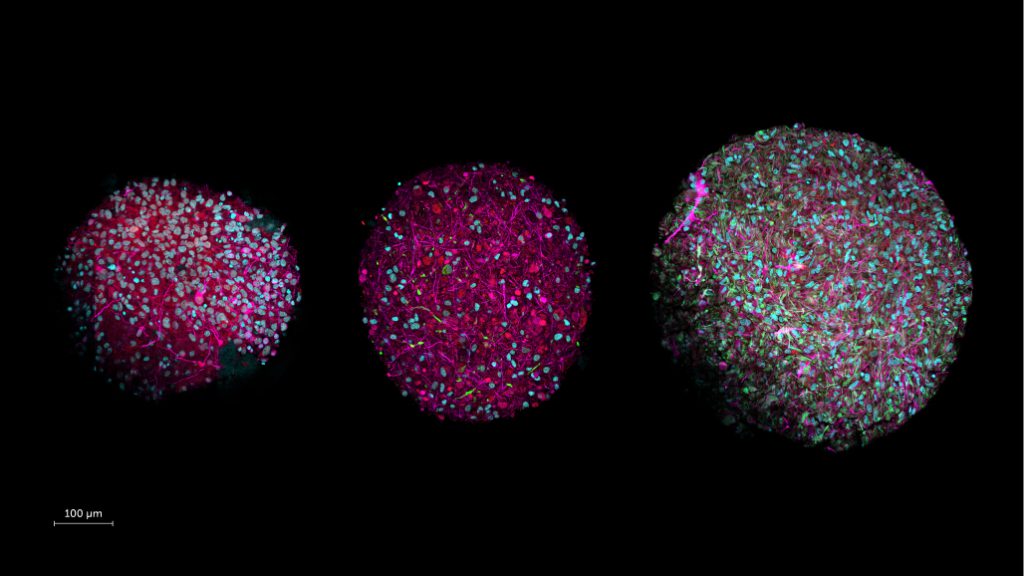 Scientists unveil plan to create biocomputers powered by human brain cells + interview with Prof Thomas Hartung (senior author of the paper)