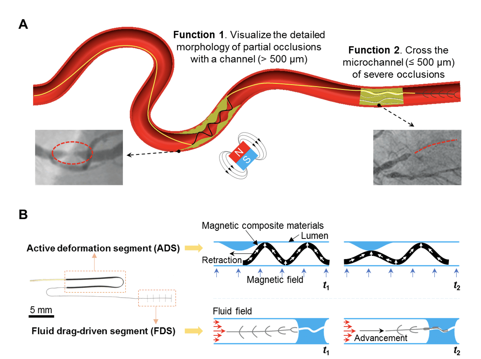 Soft robotic tool provides new ‘eyes’ in endovascular surgery